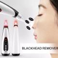 Máy làm sạch lỗ chân lông, ngăn mụn đầu đen, mụn cám
