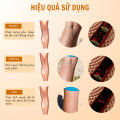 Miếng dán giảm suy giãn tĩnh mạch lưu thông khí huyết (Túi 12 miếng), 1 túi