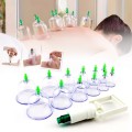 Bộ giác hơi không dùng lửa 12 ống tiện lợi